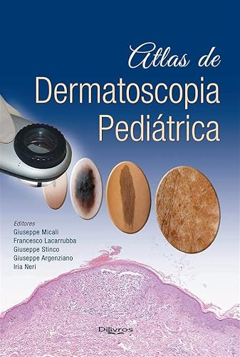 Atlas De Dermatoscopia Pediatrica