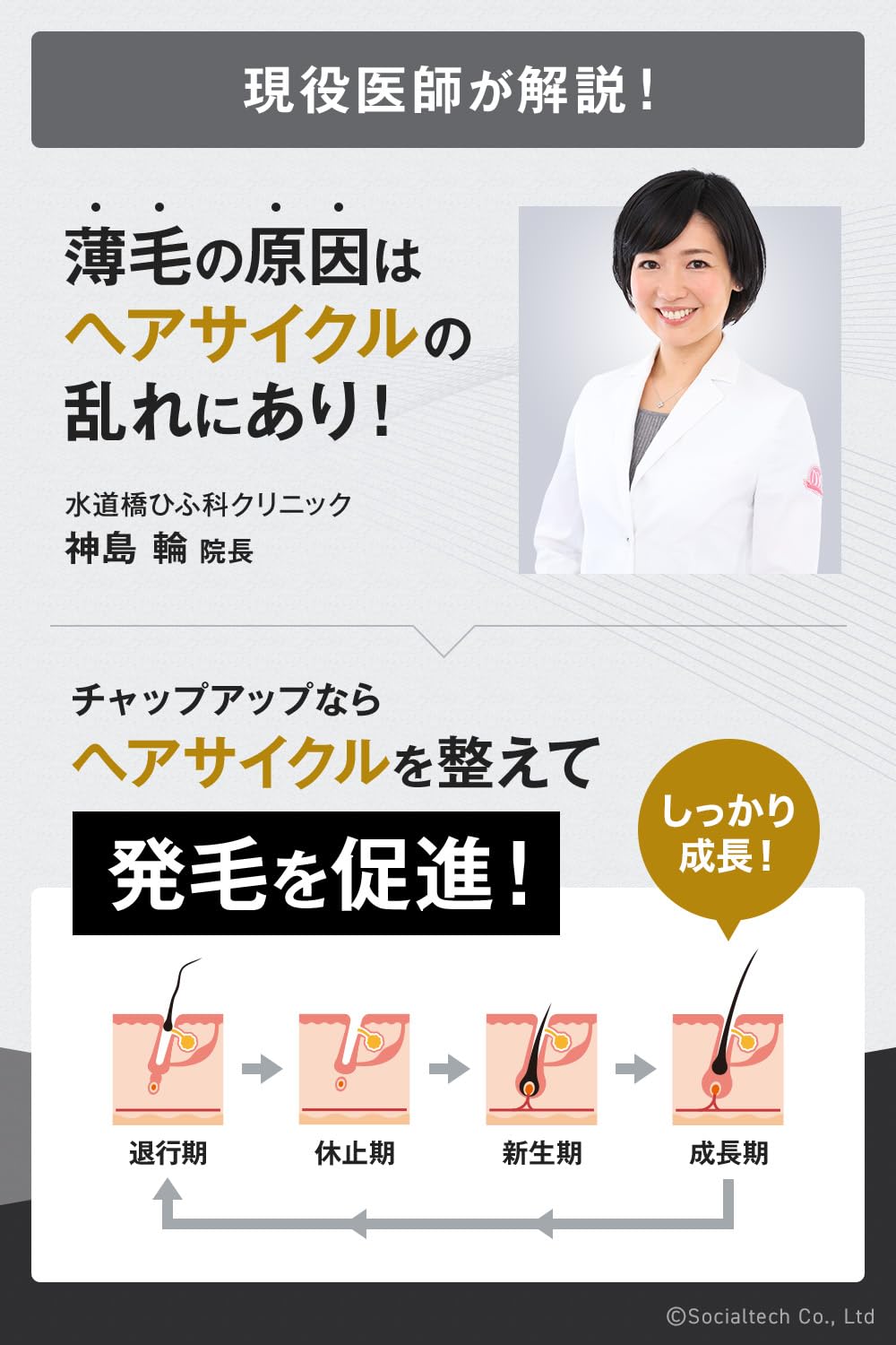 Amazon | 【毛髪診断士(R)と共同開発】 チャップアップ 医薬部外品  