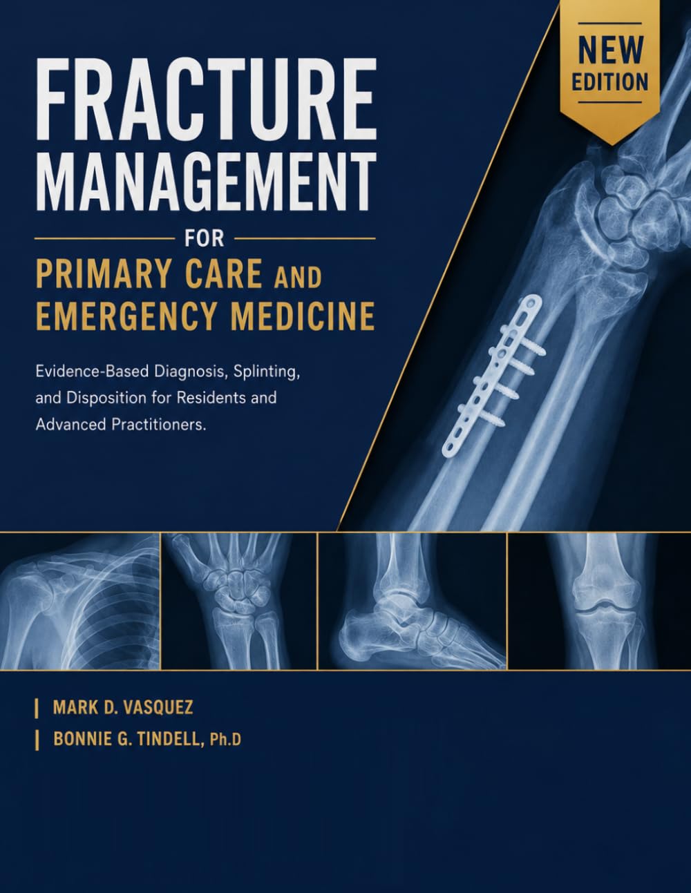 FRACTURE MANAGEMENT FOR PRIMARY CARE AND EMERGENCY MEDICINE: Evidence-Based Diagnosis, Splinting, and Disposition for Residents and Advanced Practitioners.