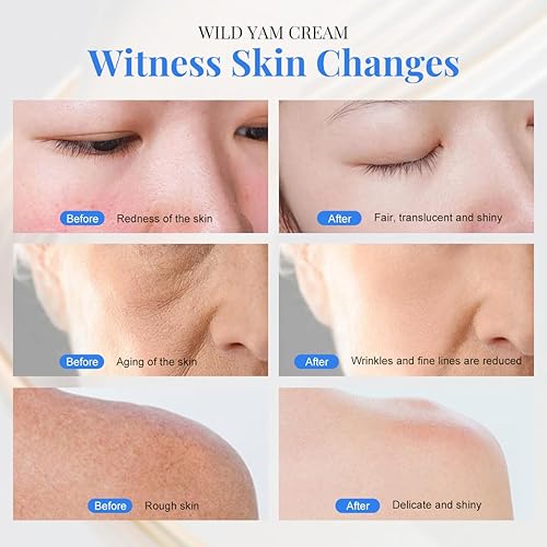 Miniatura 5 de Crema de ñame silvestre, crema de ñame silvestre orgánica para el equilibrio hormonal, sudores nocturnos naturales para hombres y mujeres que