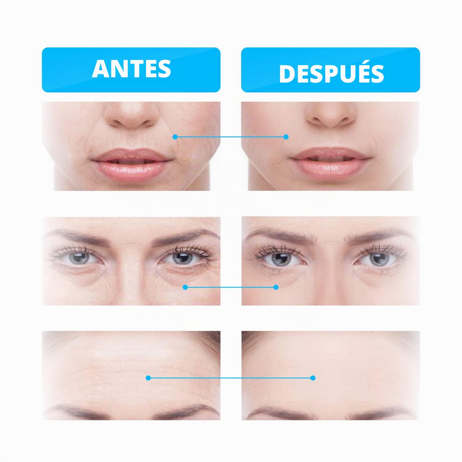 Dispositivo GESS MT para terapia de microcorriente, masaje de rodillos, eliminación de arrugas antienvejecimiento, tonal para la piel, cuidado, levantamiento facial