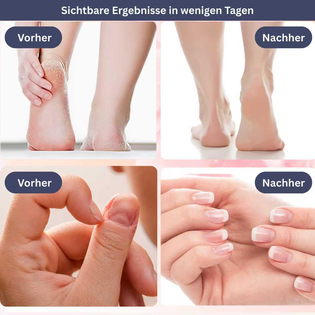 gesundpur SamtFuß Pro – Elektrischer Hornhautentferner 2-in-1 Pedikürezubehör, Fußfeile und Nagelschleifer, Professionelles Hand- und Fußpflegegerät zur Hornhautentfernung