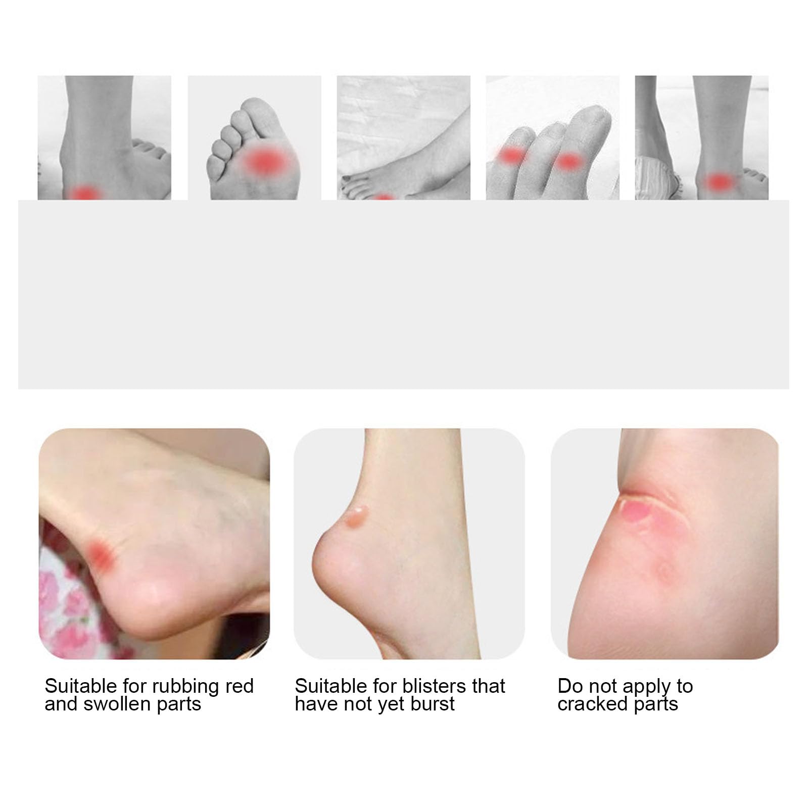 Blister Pad 20 Sztuk Samoprzylepny żel Zapobiegający Pocieraniu Plaster na Pęcherze do Stóp i Palców