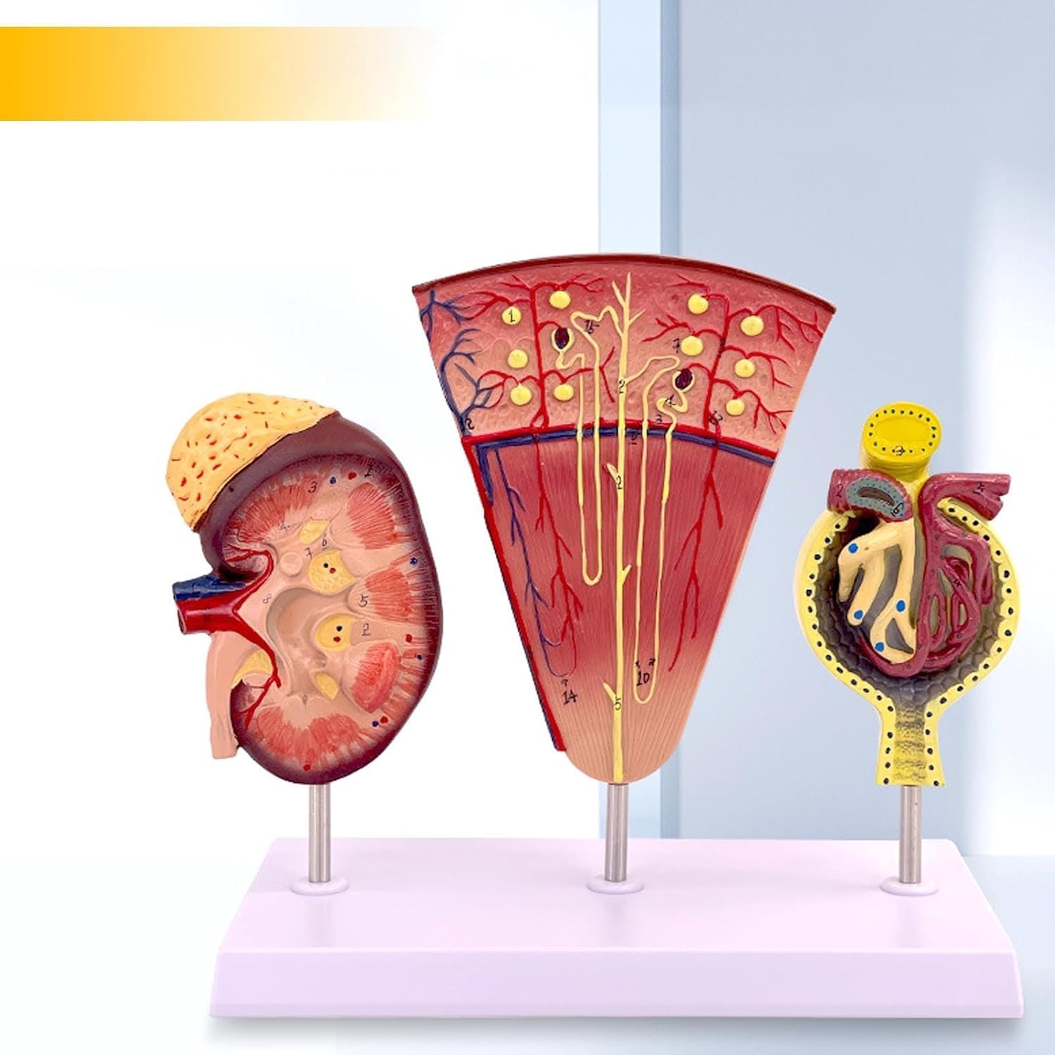 Model anatomiczny ludzkiej nerki, 3-częściowy powiększony model anatomiczny struktury kłębuszków nerkowych, służący do zademonstrowania budowy i funkcji nerek.
