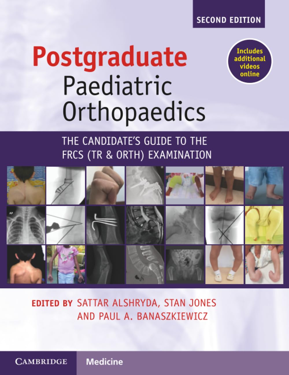 Postgraduate Paediatric Orthopaedics: The Candidate's Guide to the FRCS(Tr&Orth) Examination