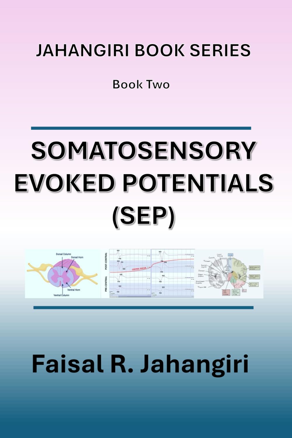 Somatosensory Evoked Potentials (SEP): Book Two (Jahangiri Book Series)