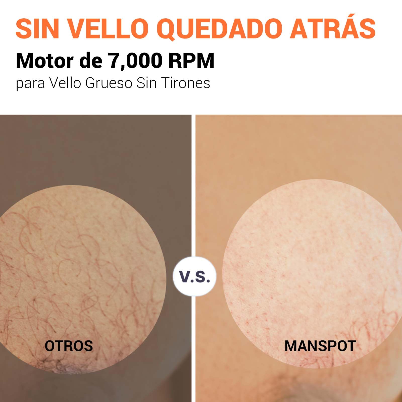 MANSPOT Afeitadora Corporal Masculina, Depiladora Corporal Hombre con Cuchilla de Cerámica Desmontable, IPX7 Resistente al Agua, Seco y Húmedo, para Axilas, Pecho, Piernas y Genitales