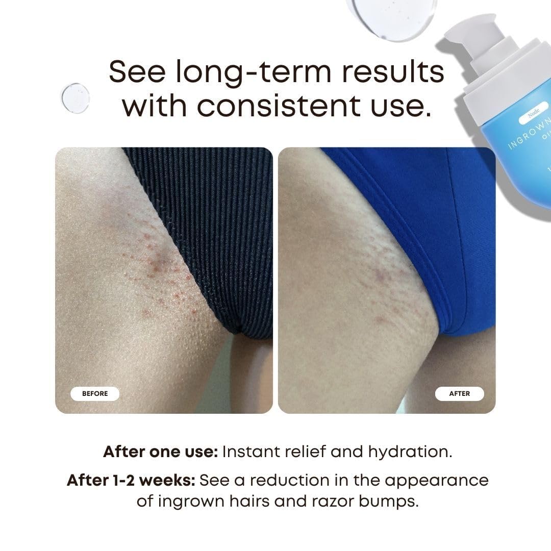 Bushbalm Ingrown Hair Oil - Targets Ingrown Hairs, Razor Bumps and Post Shave Irritation - Soothes and Hydrates Skin, 30 ml - Nude