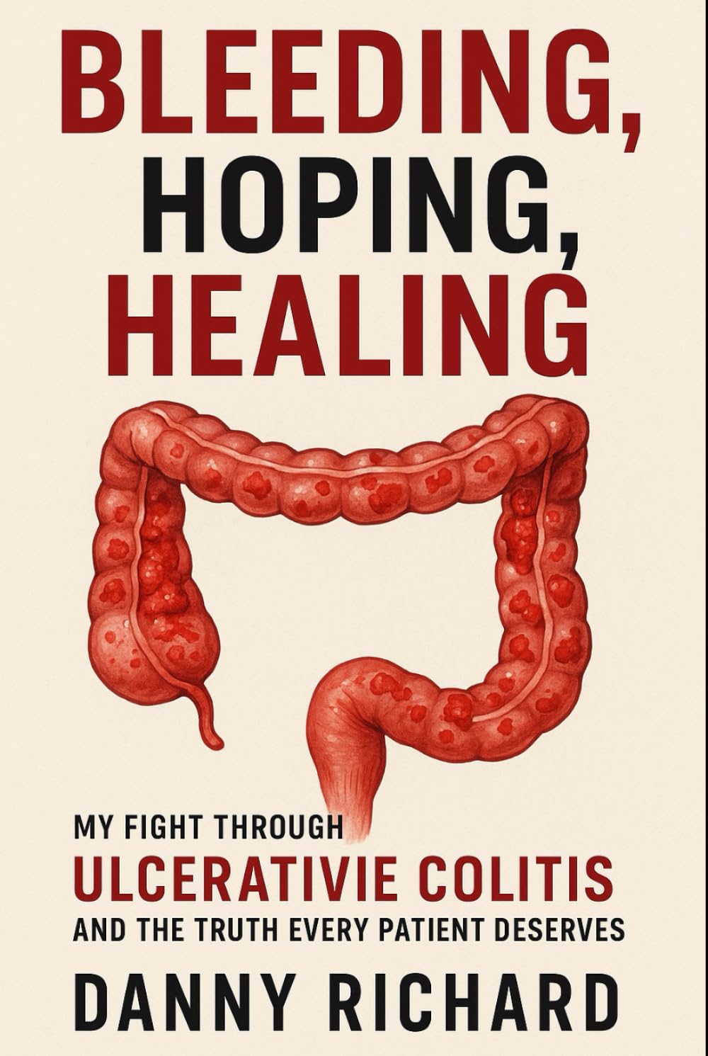Bleeding, Hoping, Healing: My Fight Through Ulcerative Colitis and the Truth Every Patient Deserves