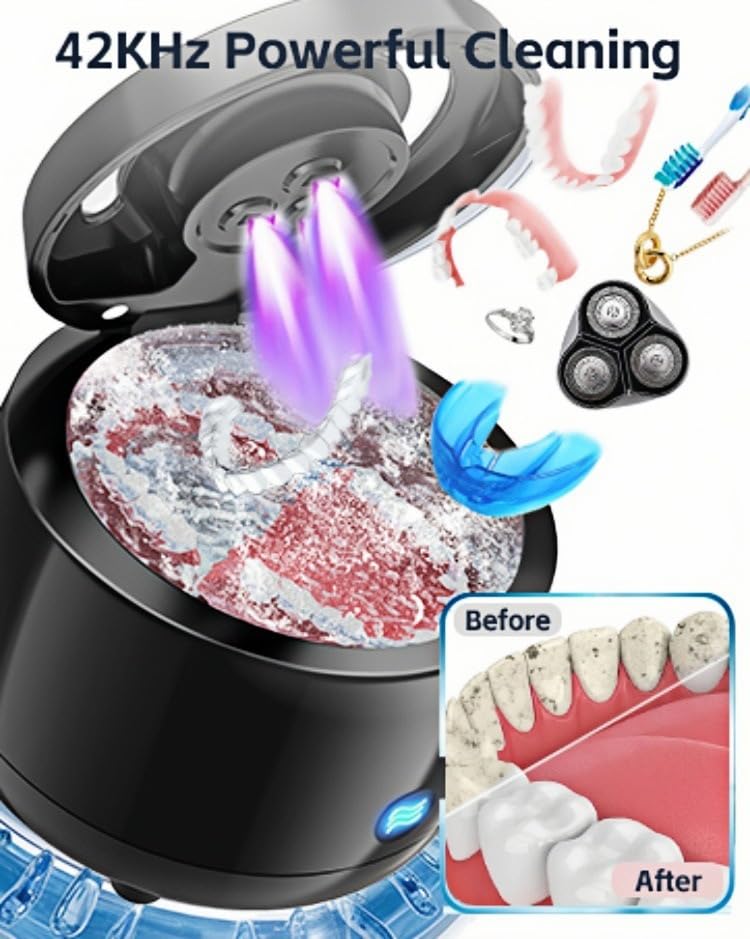 Ultrasonic Retainer Cleaner, 43kHz Denture and Aligner Cleaning Pod for Mouth Guards, Night Guards, Dental Trays, Braces, Toothbrushes, Jewelry, 180ML Capacity