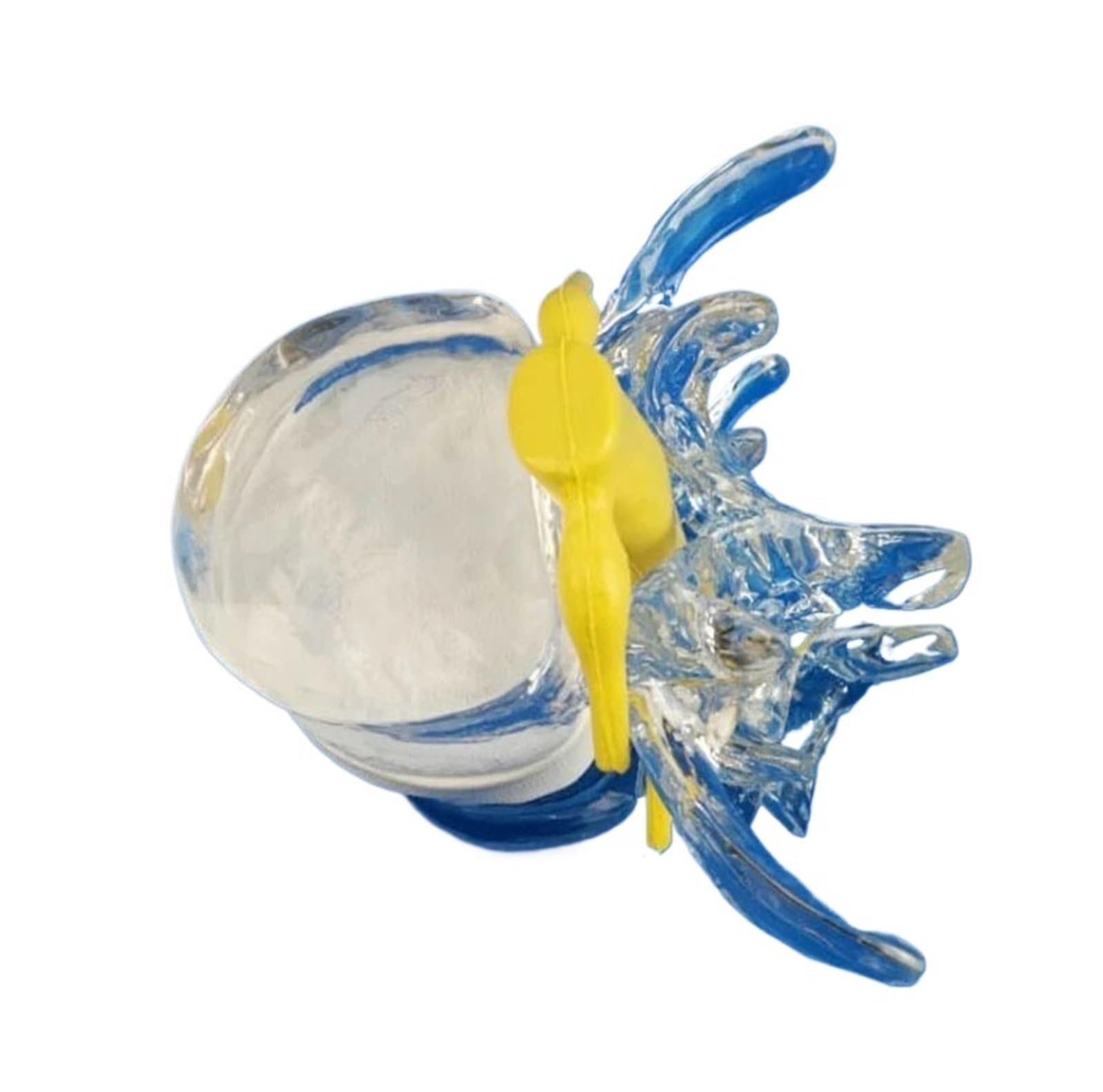 GTHTUHFD Human Lumbar Vertebrae Skeleton Anatomy Degenerative Lumbar Disc Herniation Demonstration Model Spine Medical Aids