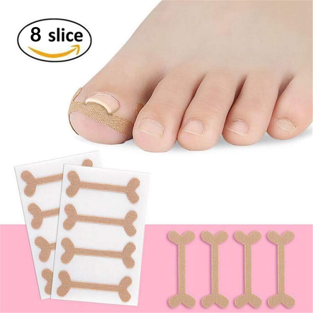 32 pcs Ingrown Toenail Correction Patch, Breathable Elastic Cotton Glue