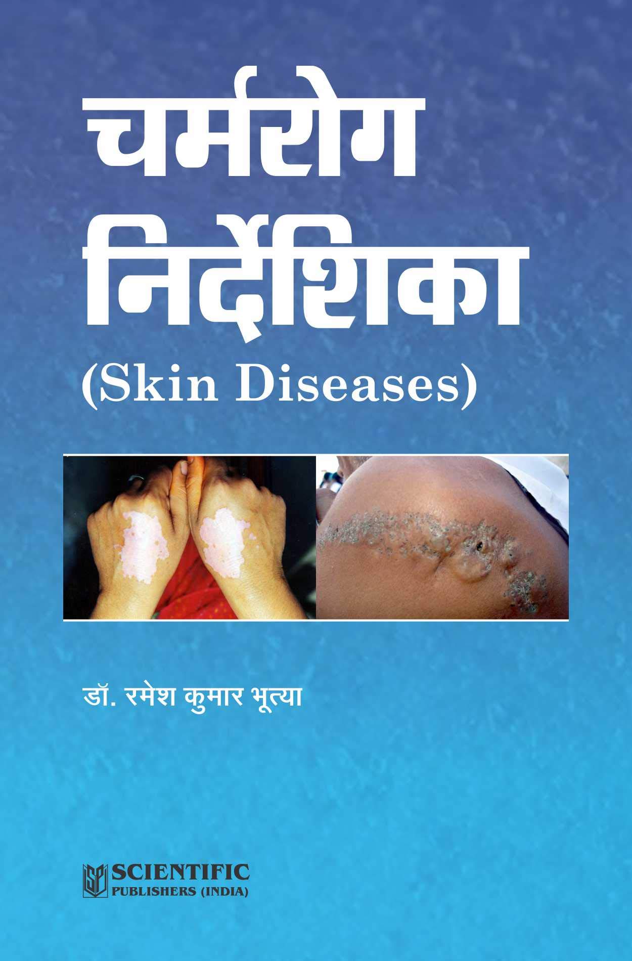 Buy Skin Diseases (Hindi) — BookShops.in