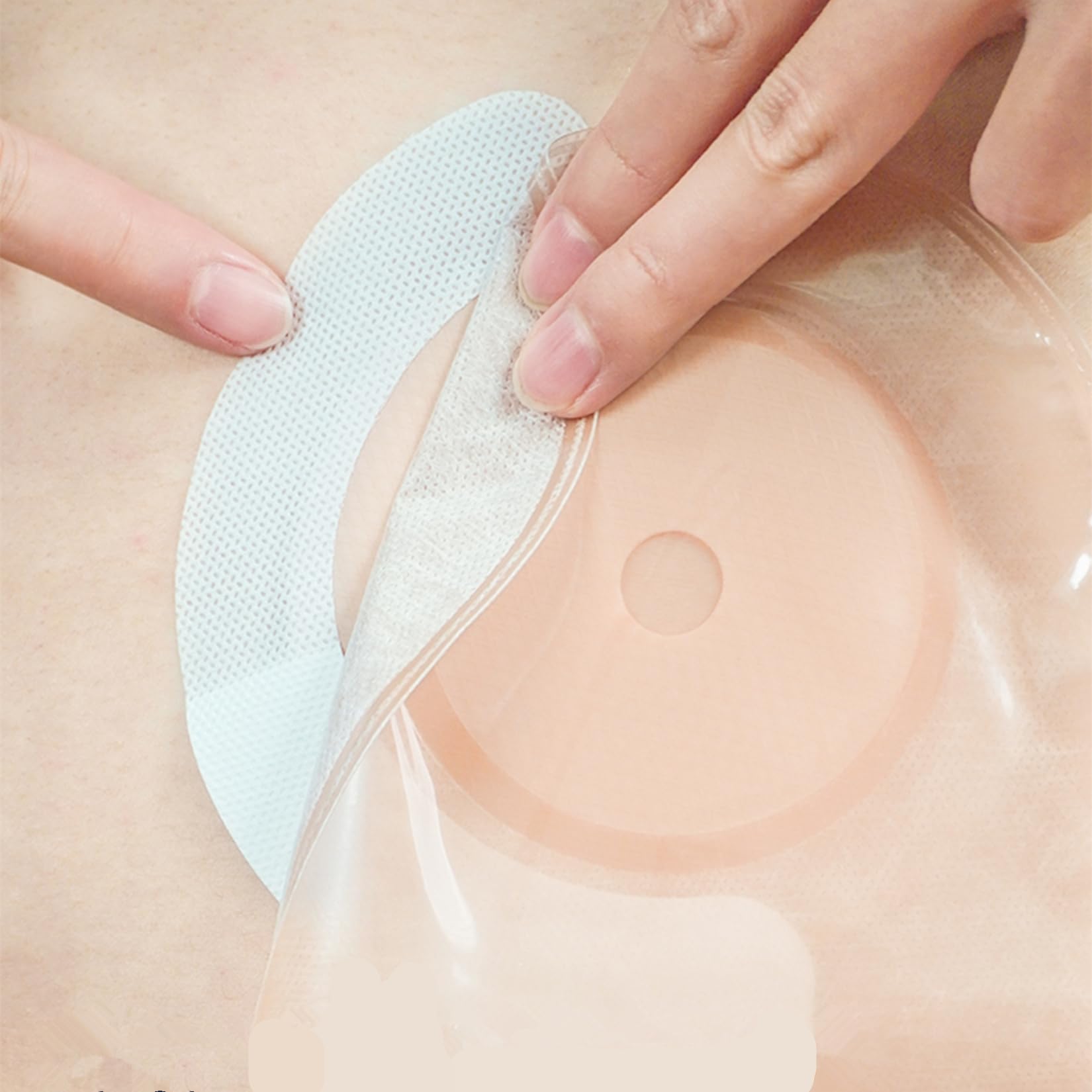 Ostomy Barrier Strips - 20pcs Elastic Barrier Tapes for Colostomy Bags, Leak-Proof Skin Adhesive Extender Ostomy Supplies