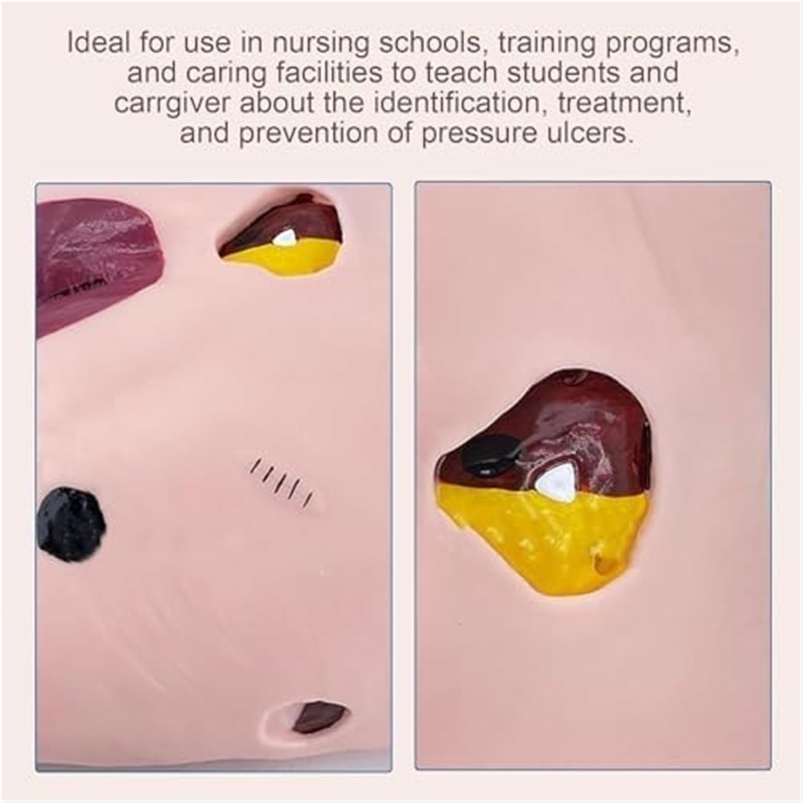Modello umano per l'educazione infermieristica, simulatore di cura delle piaghe da decubito, ausilio didattico medico per professionisti infermieristici, strumento di formazione efficace per studenti