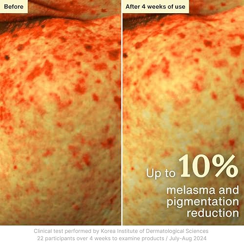 Miniatura 12 de Rothea Crema de resiliencia, antienvejecimiento con Bakuchiol 10,000 ppm (alternativa natural al retinol), hidratante facial, crema para el cuello