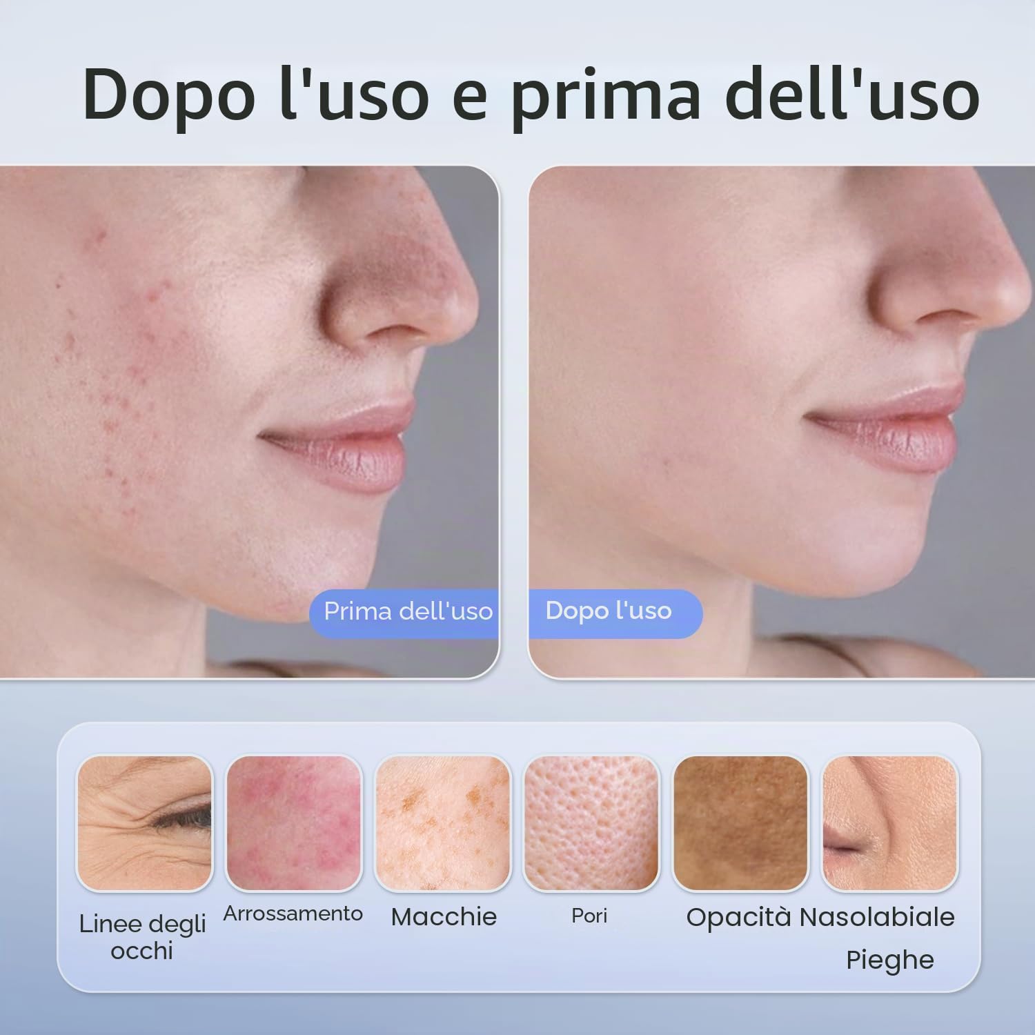 Terapia a Luce Rossa per il Viso, Approvata dalla FDA, Maschera LED con 4 Modalità, Luce Blu, Rossa e Infrarossa, Dispositivo PDT per Cura Professionale di Viso e Corpo