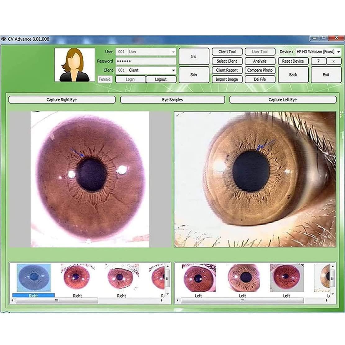Telecamera di Analisi Dell'iride,Interfaccia USB 2.0 Eye Camera Iriscope,Analizzatore Lampada Sinistra/Destra da 5,0 Milioni di Pixel con Obiettivo Dell'iride 30x E Software di Analisi