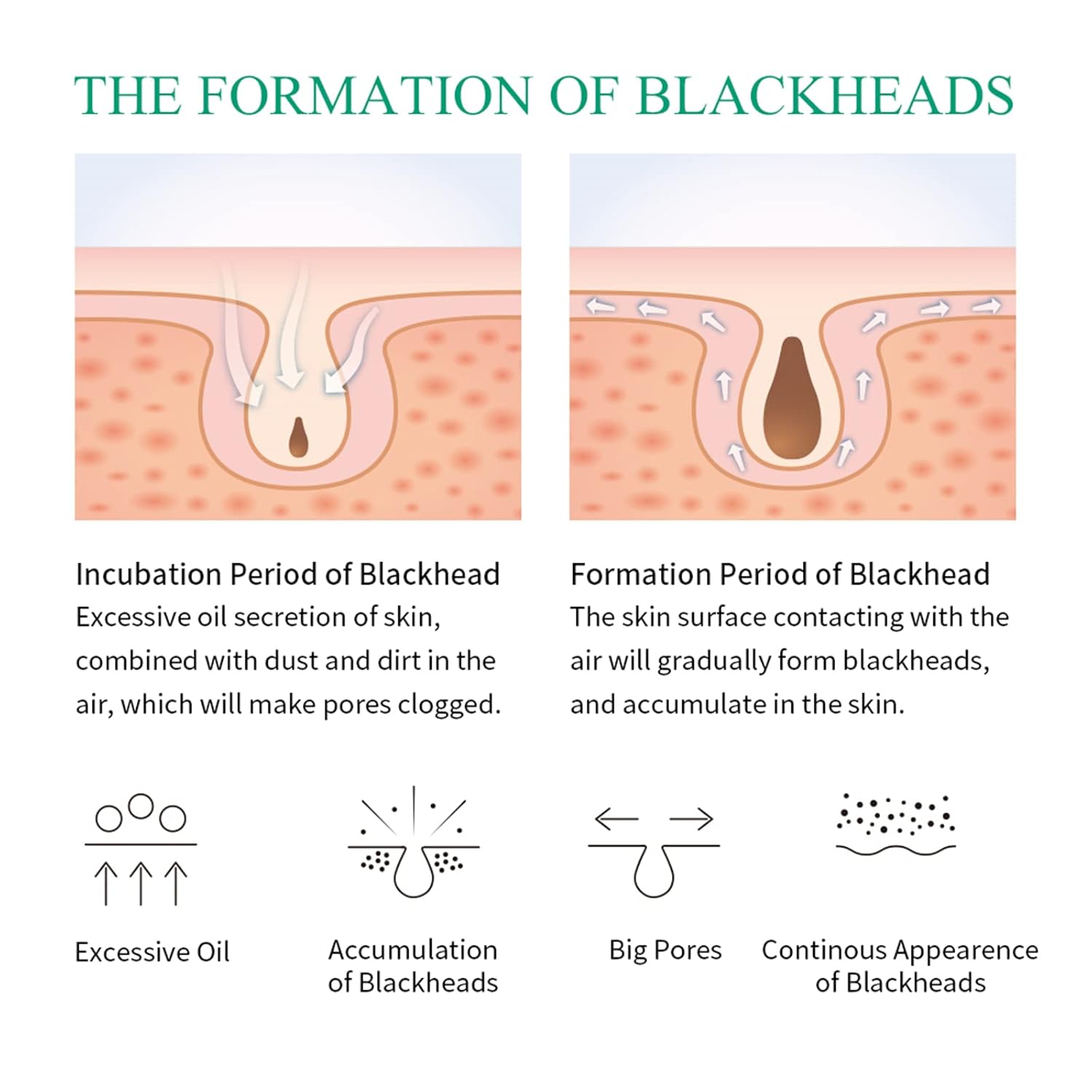 Blackhead Remover Pore Strips, Nose Strips for Instant Blackhead Blackhead Remover Pore Strips, Nose Strips for Instant Blackhead