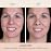 PUR Beauty 4-in-1 Pressed Mineral Makeup Powder Foundation with SPF 15 - Concealer & Finishing Compact Pressed Powder for Face - Buildable Medium to Full Coverage Foundation Powder (Linen)