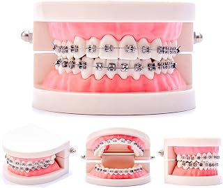 Easyinsmile Dental Orthodontic Model Teeth Model with Metal Bracket Tooth Model with Brace for Patients Communication