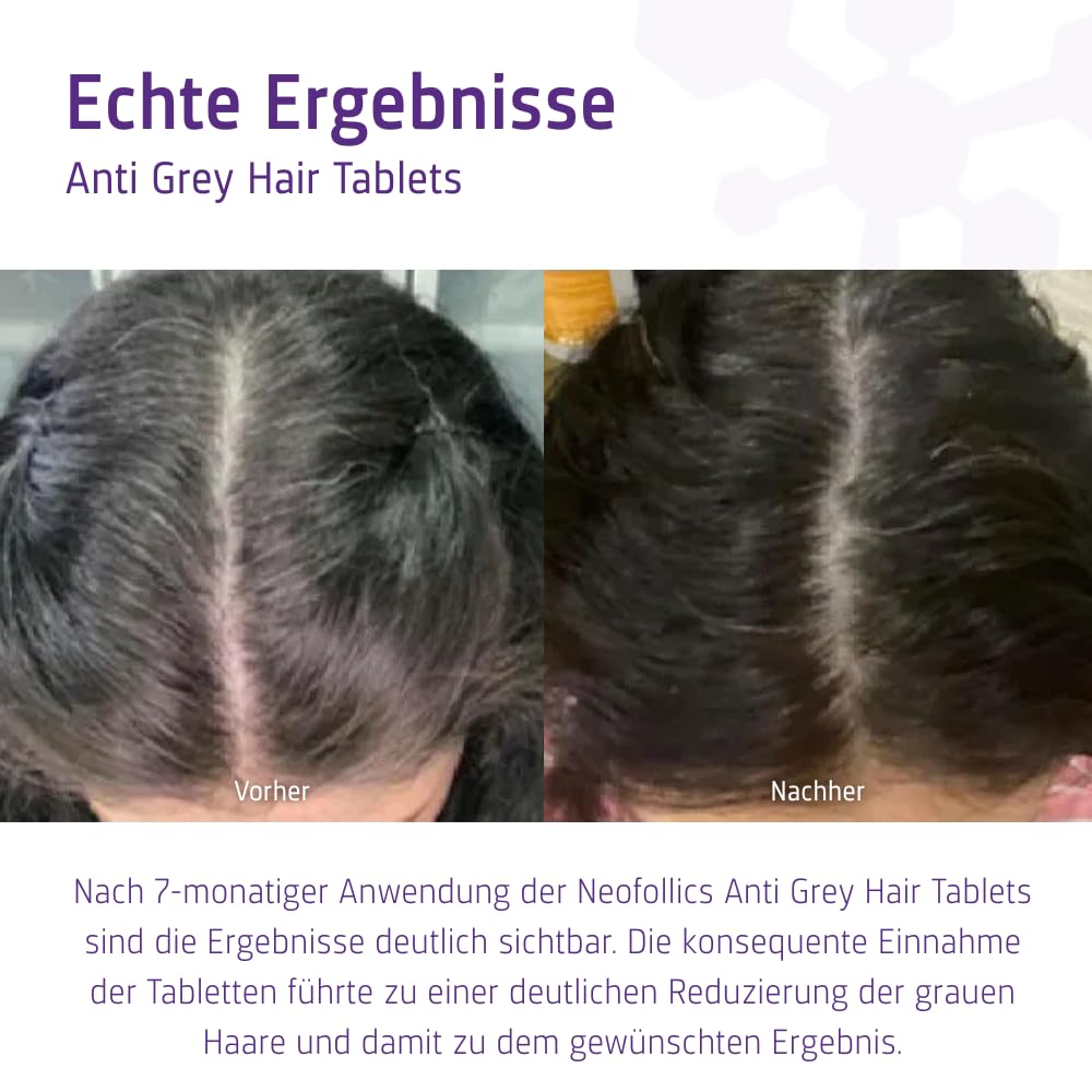 Neofollics Anti-Grau-Tabletten – 60 Stück – Zweistufiges Supplement mit Katalase & Melanin Complex™ – Unterstützt die Natürliche Haarpigmentierung – Vegane Formel – für Männer & Frauen