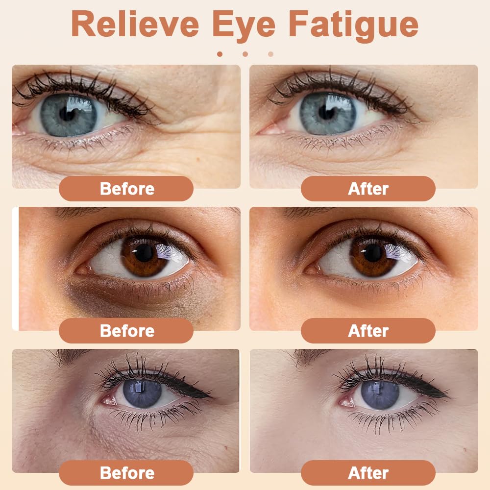 Masseur Oculaire à Luminothérapie Rouge, Massage Yeux à Lumière Rouge, Microcourant Masseur pour Les Yeux, Massage des Yeux pour éliminer les Cernes, les Poches Sous les Yeux, Anti-Rides