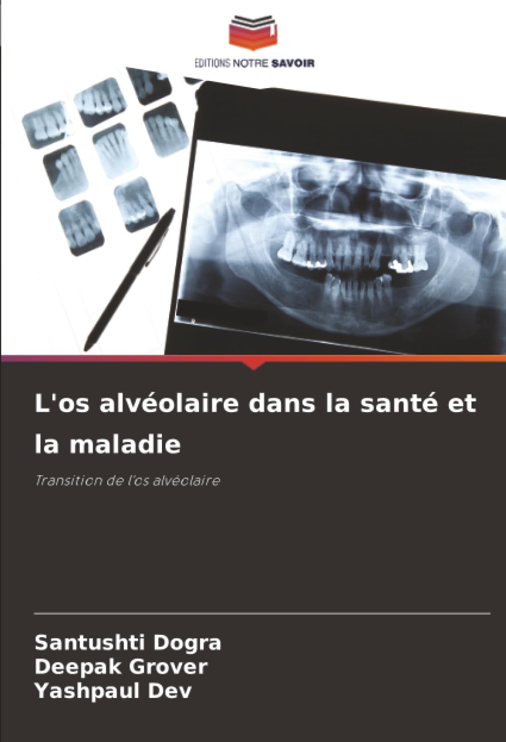 L'os alvéolaire dans la santé et la maladie: Transition de l'os alvéolaire