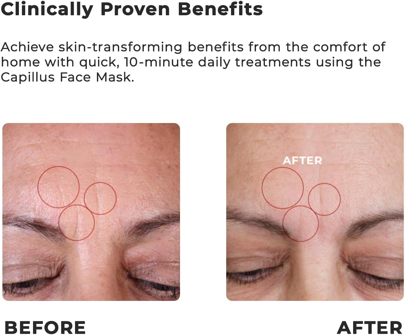 Capillus Red Light Therapy Mask – LED Face Mask Light Therapy 4 in 1 Infrared, Blue & Pink Red Light Mask Face Therapy Device - Image 3