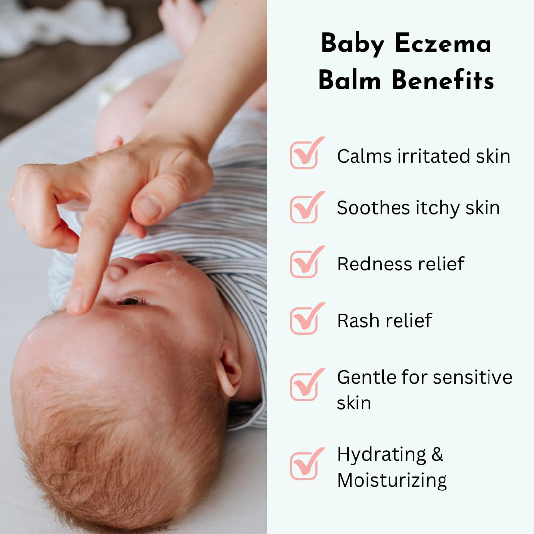Irene Organics Baby Eczema Relief Balm, Healing Ointment Baby Moisturizing Cream for Eczema, Dry, Itchy Skin. Award Winning Baby Skincare for Sensitive Skin, Safe for Newborns, Kids and Adults
