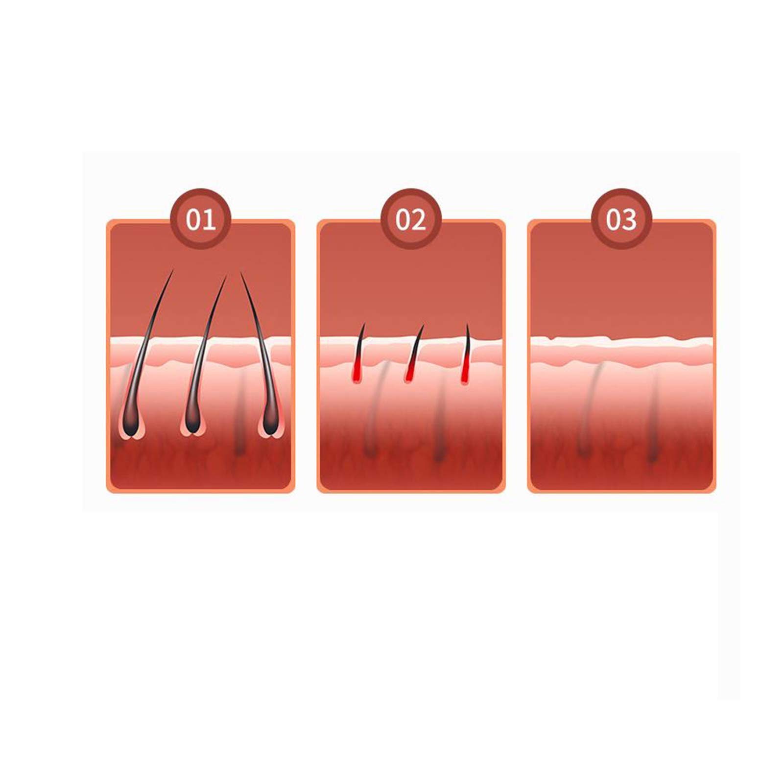 Dispositivo Di Rimozione Dei Peli Del Punto Di Congelamento Epilatore Domestico Di Depilazione Laser IPL Blu Verde Arancione