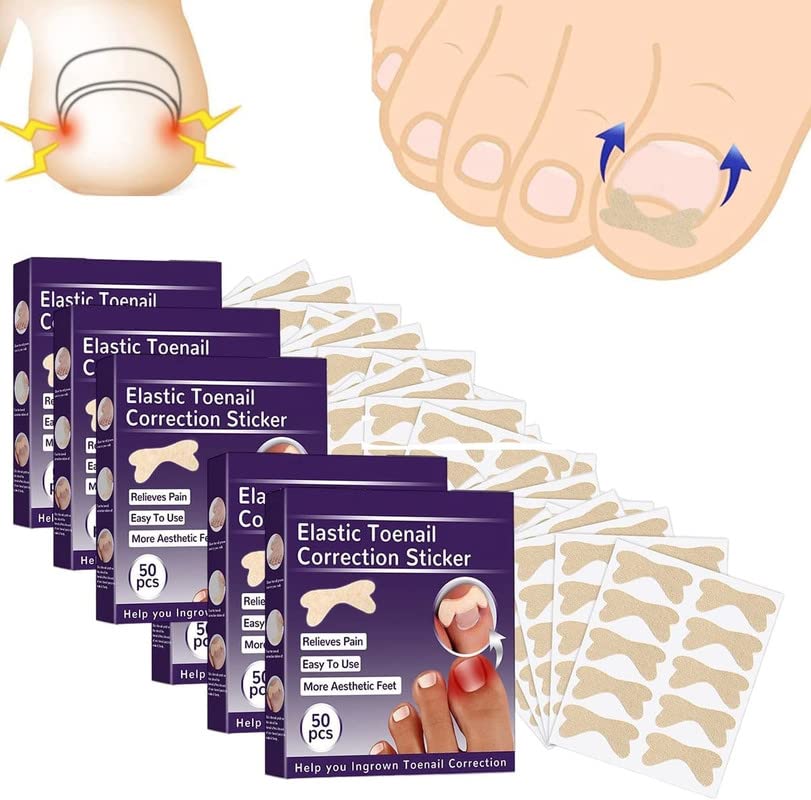 Buy Fertoe Toenail Corrector Patch 200Pcs Ingrown Toenail Corrector Strips, Ingrown Toenail