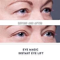 Vista 7 de Lifting de ojos instantáneo Eye Magic
