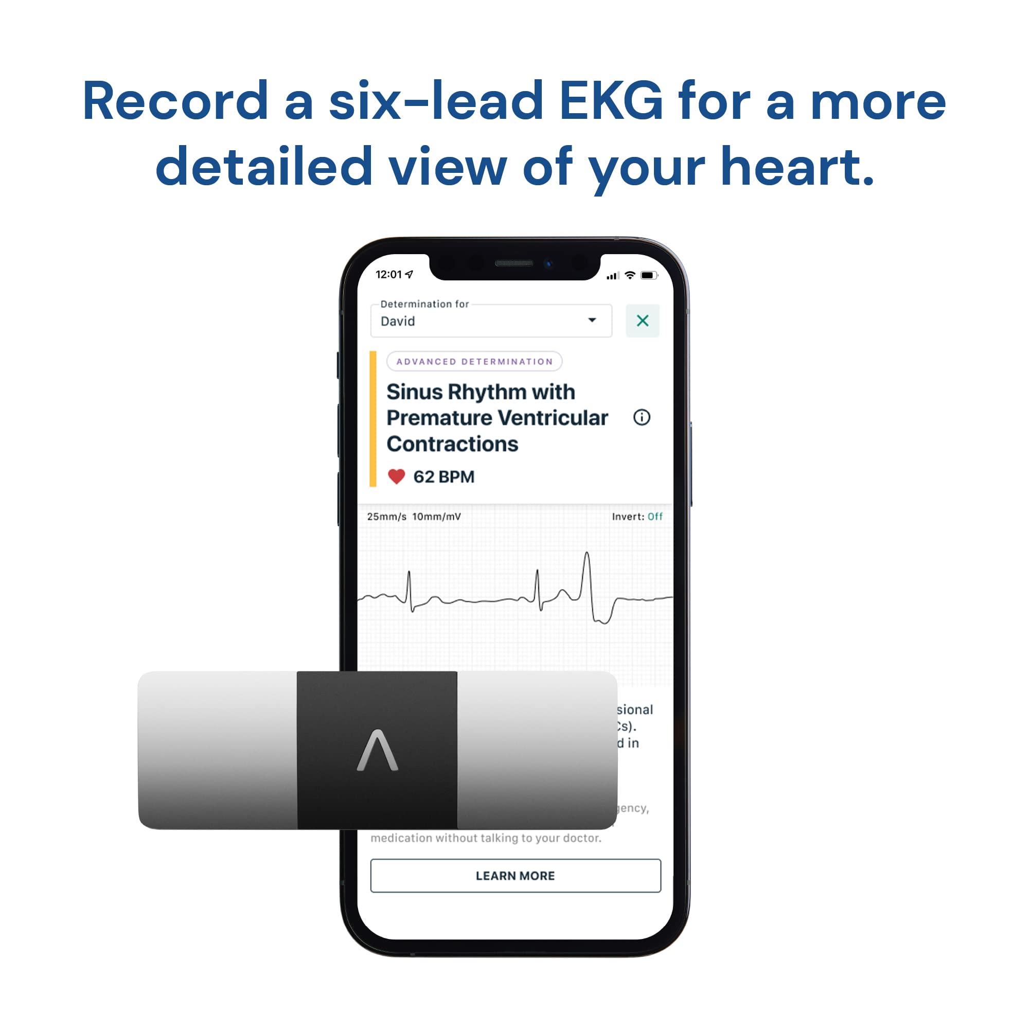 Buy KardiaMobile 6L Personal EKG (ECG) Device and Heart Monitor SixLead EKG Recording