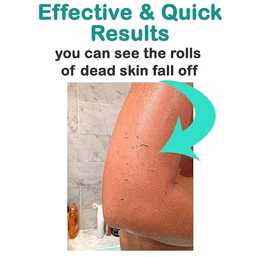 Miniatura 2 de Manopla exfoliante Body Kessa Hammam  Herramienta para el cuerpo removedor de piel muerta y seca o queratosis pilaris, hecha de 100% fibra viscosa