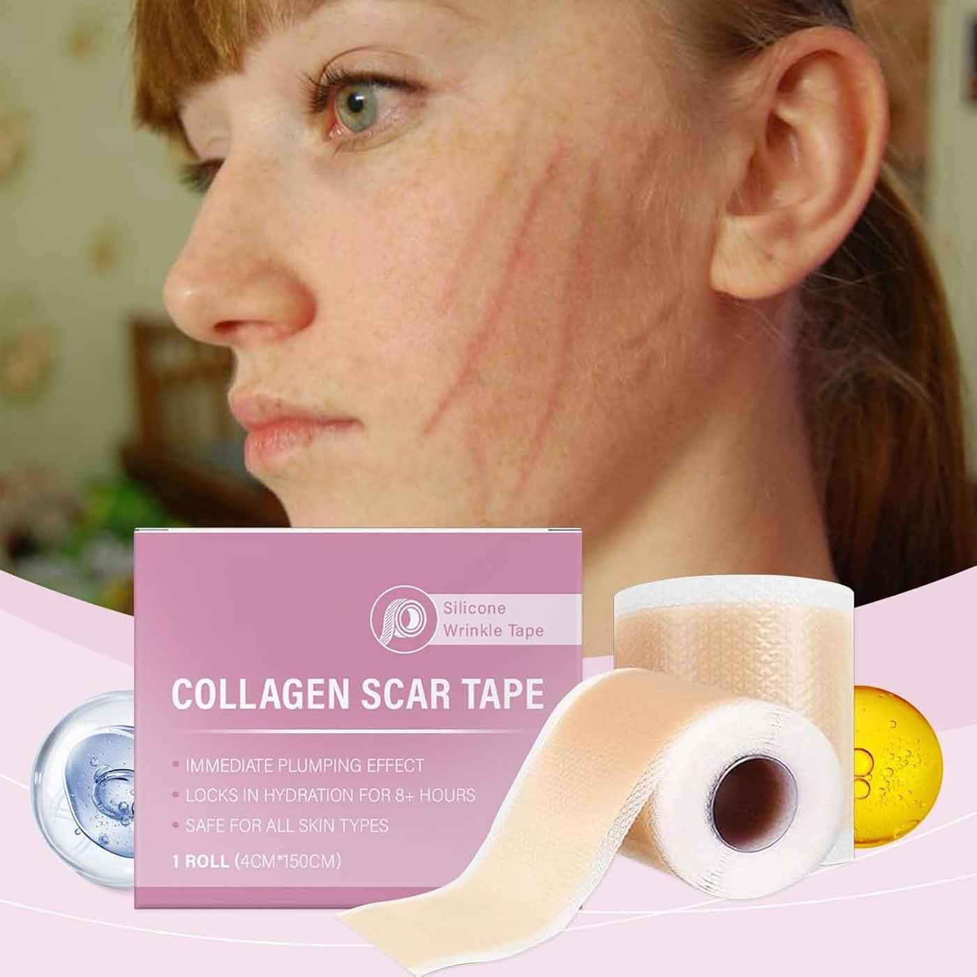 2pcs Silicone Scar Tape,Face Collagens Scar Tape,Silicone Care Patch Scars Tapes,Silicones Anti-Wrinkles Facial Sheets,Smooths Fine Lines,Extra-Large 59-Inch Roll,for All Skin Types