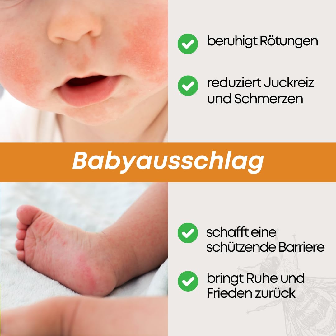 Zugsalbe & Wundsalbe 60g | Wund und Heilsalbe mit Calendula | Mighty Propolis Salbe | Wundheilsalbe | Salbe Gegen Juckreiz | Bee Enriched