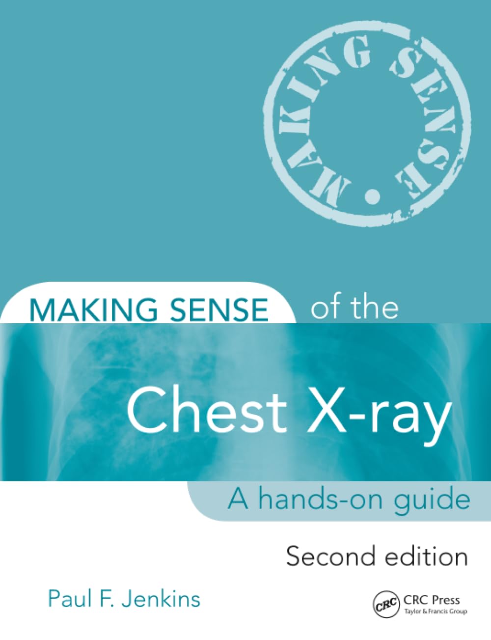 Making Sense of the Chest X-ray