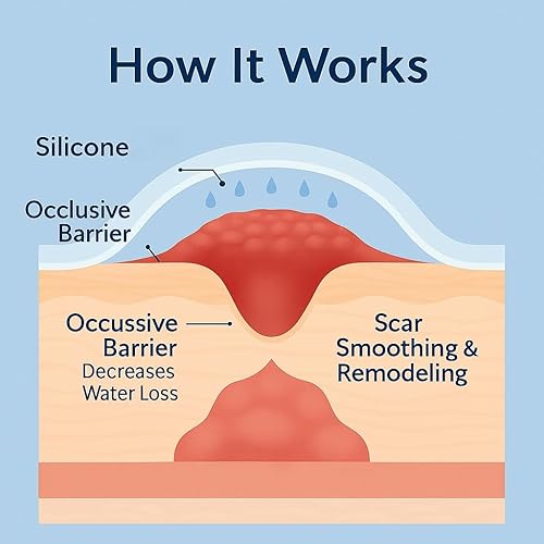 Miniatura 5 de Hojas de silicona para cicatrices, tiras de gel de silicona reutilizables de grado médico para cuerpo y cara, suaves, invisibles y flexibles, 1.4 x