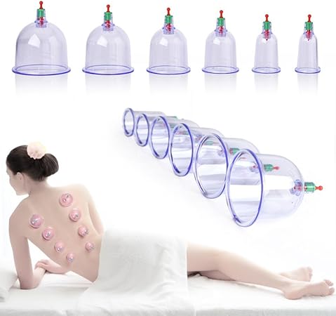 医工 カッピング Cupping a-2 吸い玉 業務用 血栓 真空浄血治療器