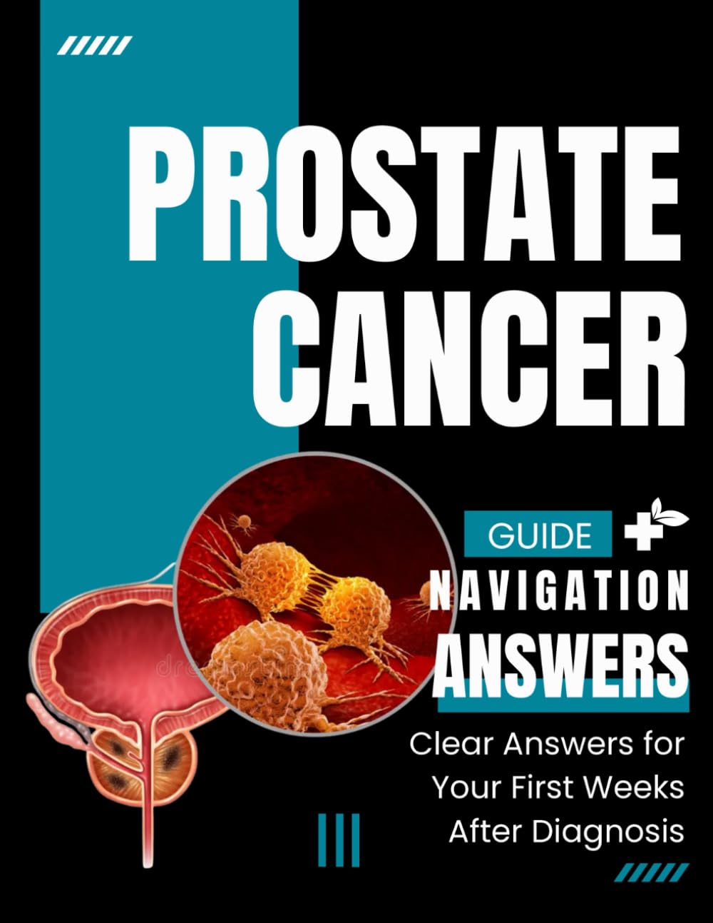 Prostate Cancer Navigation Guide: Clear Answers for Your First Weeks After Diagnosis