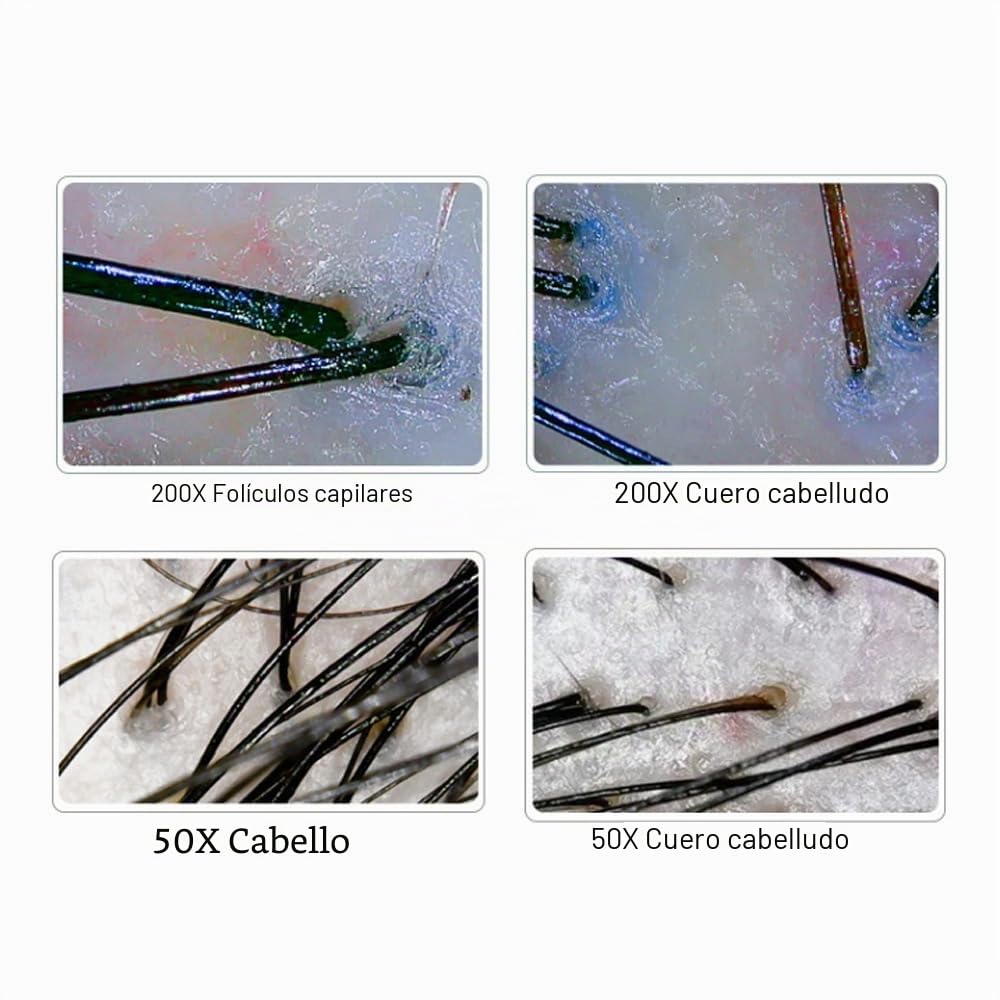 Microscopio dermatoscópico USB ultrasónico de alta resolución para diagnóstico médico y cutáneo, portátil y fácil de usar, ideal para profesionales de la salud