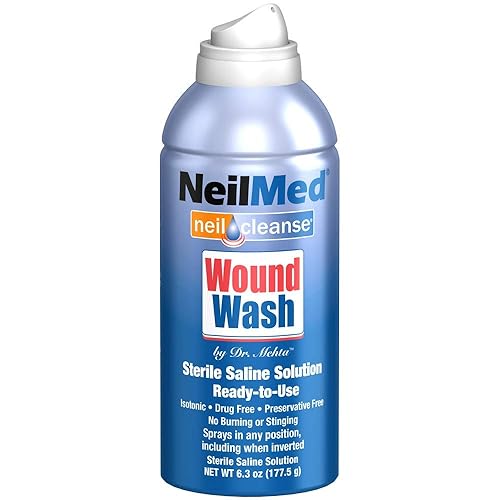 How To Clean Dry Blood From Nose Cleanstuffeasy