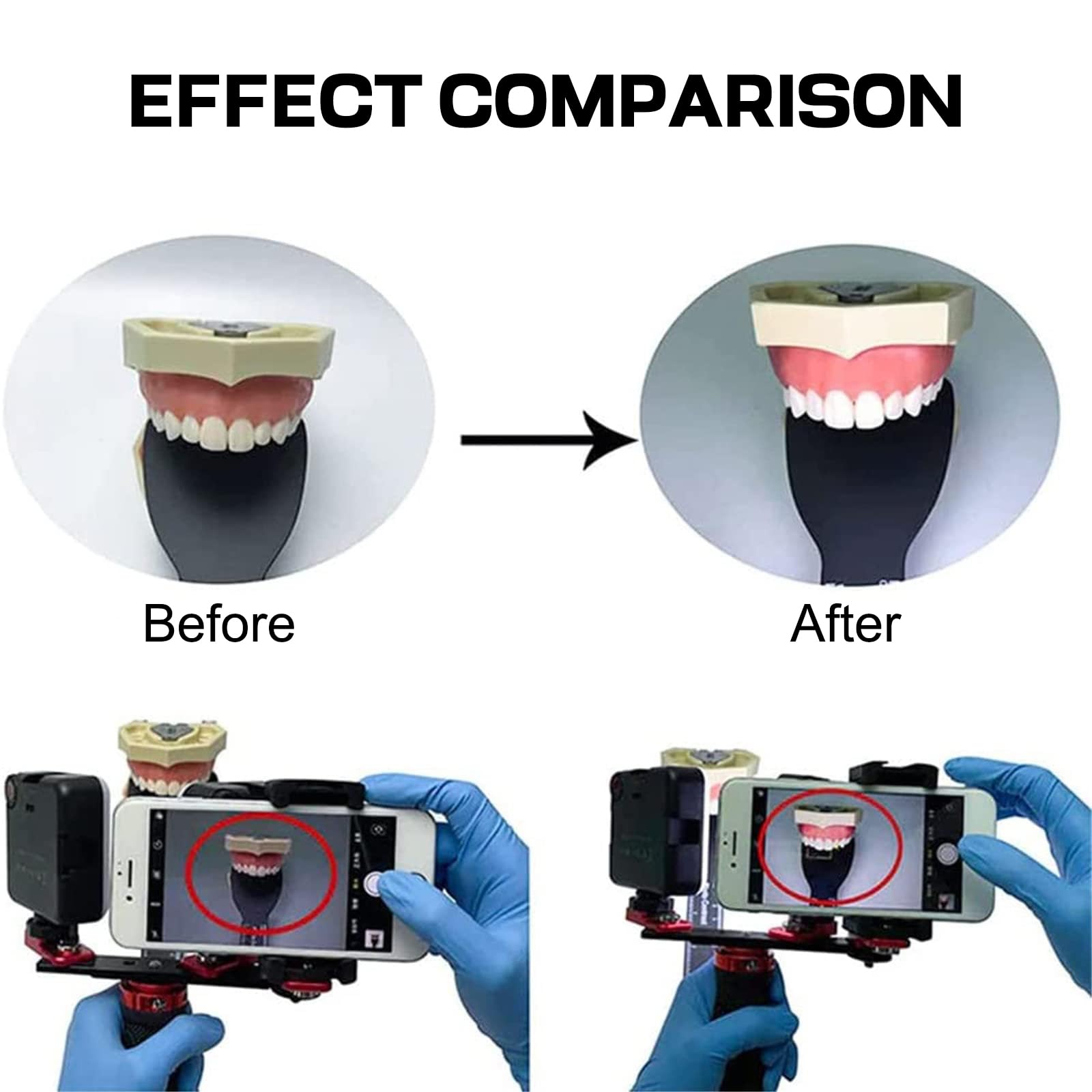 Zestaw do fotografii stomatologicznej z lampą błyskową Profesjonalna latarka do aparatu i wideo do aparatu ustnego Narzędzie do fotografii zębów do stomatologii (3000-6000 K)