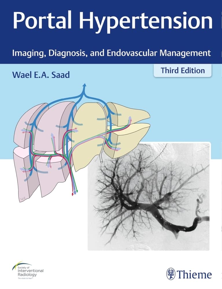 Buy Portal Hypertension: Imaging, Diagnosis, and Endovascular Management — BookShops.in