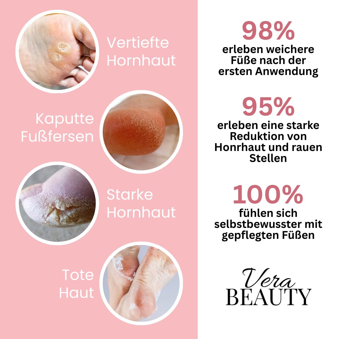 vera beauty Luva Pro - für seidig glatte Füße Motorisierter Hornhautentferner mit einstellbarer Geschwindigkeit, Ersatzpads für weiche Füße und effektive Pflege bei rissiger Haut.