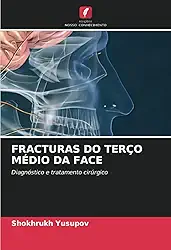 Fracturas Do Terço Médio Da Face: Diagnóstico e tratamento cirúrgico