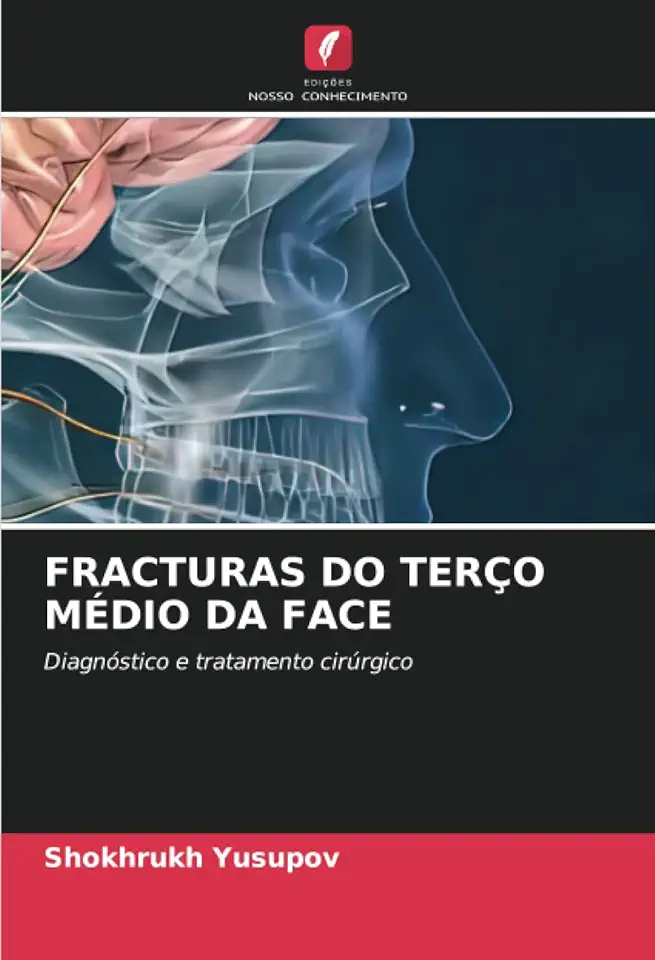 Fracturas Do Terço Médio Da Face: Diagnóstico e tratamento cirúrgico
