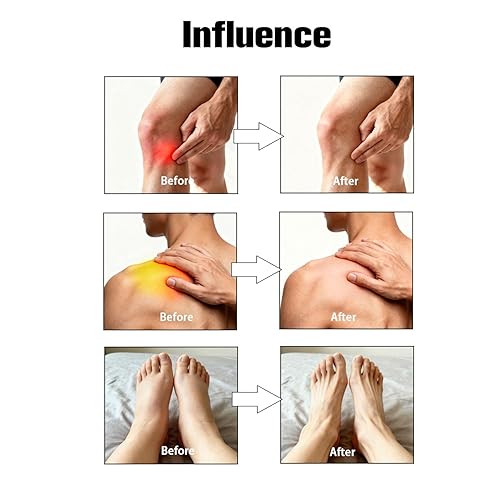 Miniatura 5 de Capsacare - Crema para aliviar los nervios  Comodidad de los nervios específicos con capsaicina y árnica  Fórmula bien absorbente para manos, pies,