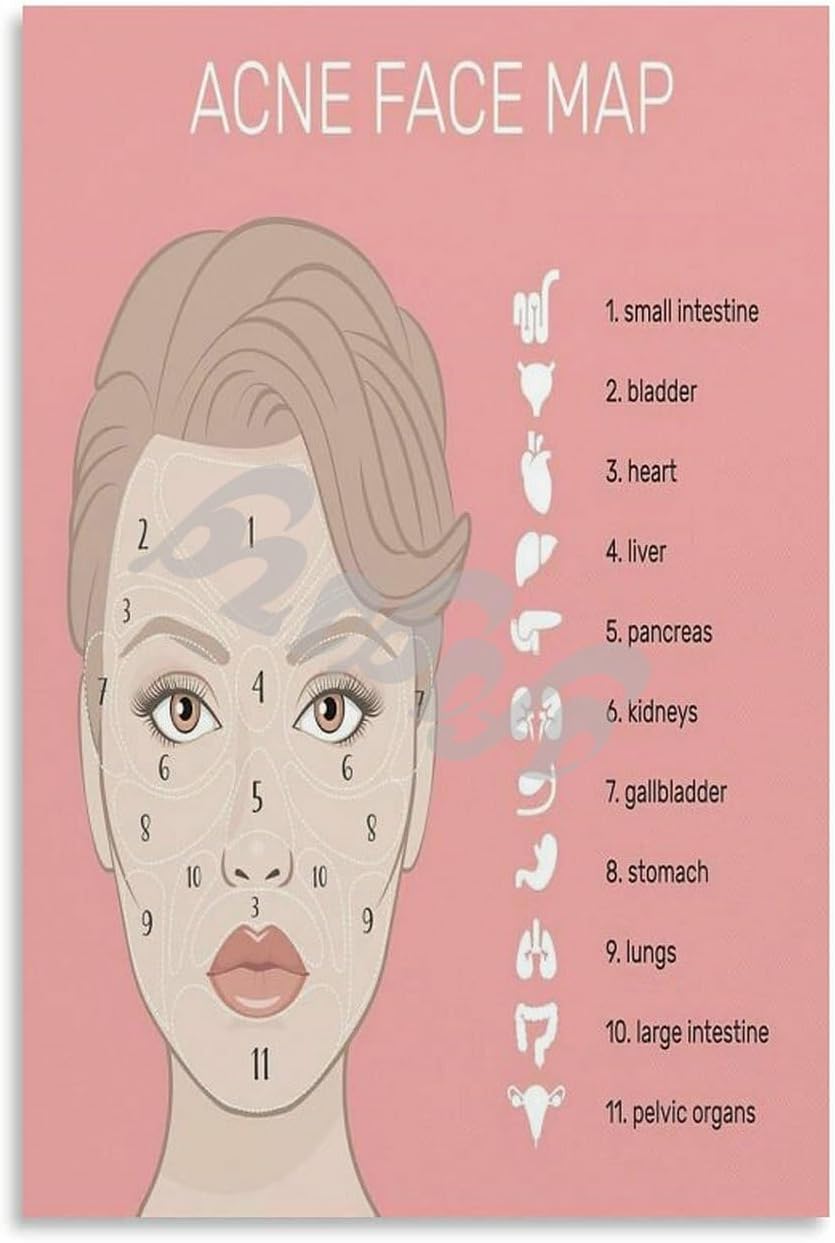 Acne Face Map Guide Art Poster Facial Treatment Poster Beauty Salon Poster Canvas Painting Posters And Prints Wall Art for Living Room Bedroom Decor 08x12inch(20x30cm) Unframe-style